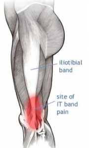 itb site of pain